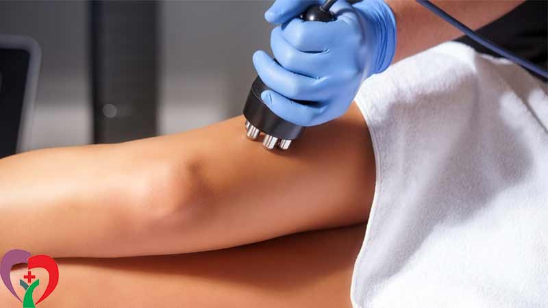 انواع سلولیت