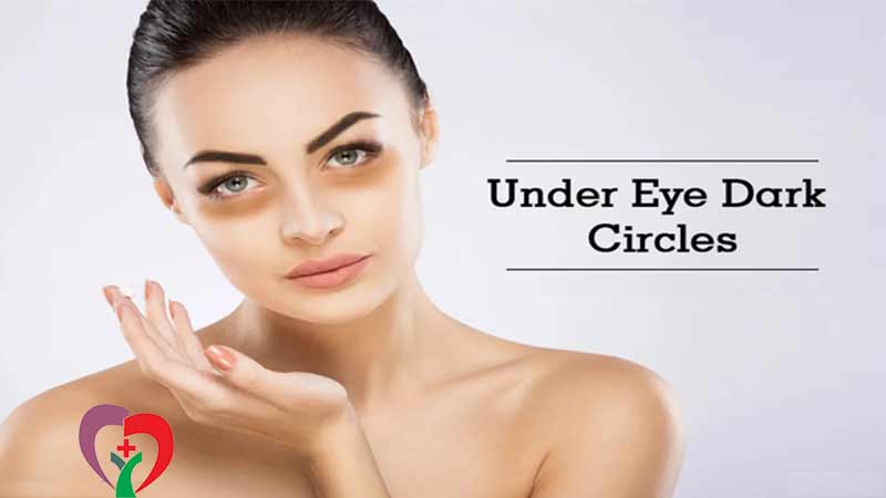 دلایل تیرگی زیر چشم