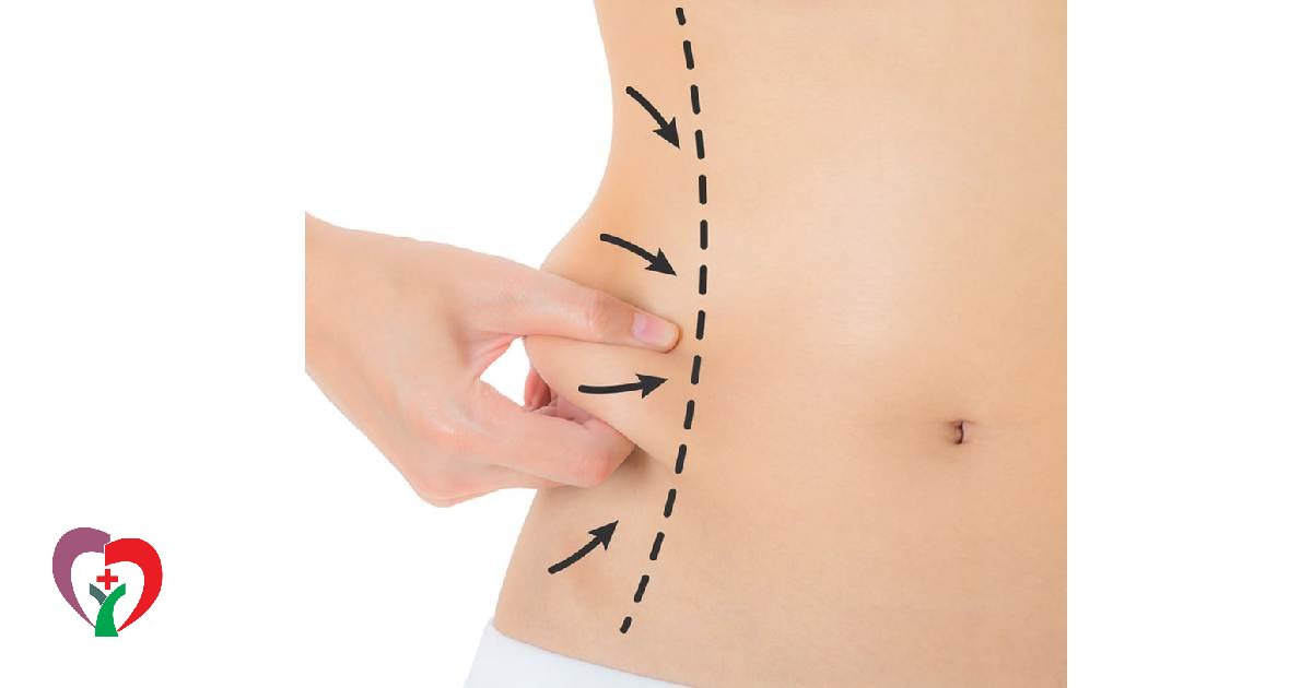 بررسی خطرات لیپوساکشن
